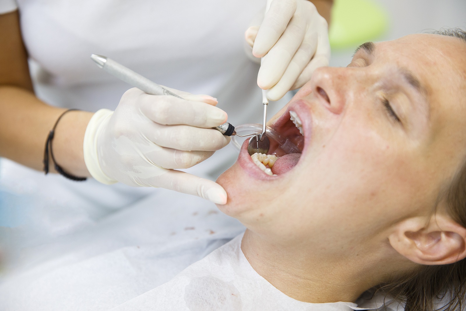 Healing After Tooth Extractions: Your Comprehensive Aftercare Guide
